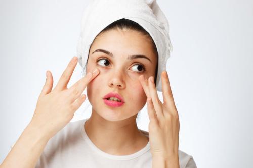 Гусиная лапка на лице. Ключевые провокаторы появления морщин в области глаз 02 Гусиная лапка на лице. Ключевые провокаторы появления морщин в области глаз 02