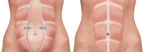 Вакуум живота до и после. Диагностика