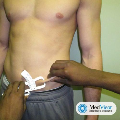 Калькулятор процента жира калипером. Как пользоваться калипером? Измеряем процент жира в организме