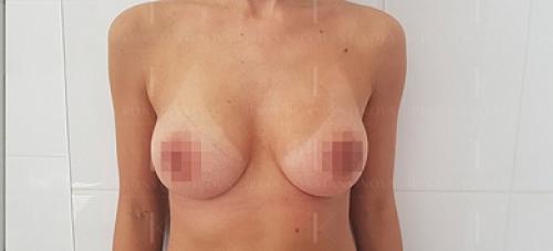 Уход за грудью во время грудного вскармливания. В чем польза грудного вскармливания 01