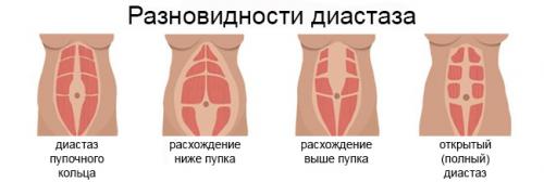 Когда можно делать массаж живота после родов. Через сколько недель после родов можно делать антицеллюлитный и другие виды массажа? 02 Когда можно делать массаж живота после родов. Через сколько недель после родов можно делать антицеллюлитный и другие виды массажа? 02