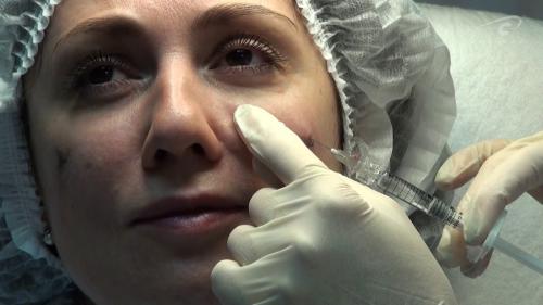 Особенности зоны вокруг глаз. Зачем нужен крем для век? 07 Особенности зоны вокруг глаз. Зачем нужен крем для век? 07