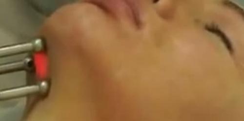 Лазерное фракционное омоложение лица в Москве. Что такое лазерное омоложение (фракционный фото-термолиз)? 02 Лазерное фракционное омоложение лица в Москве. Что такое лазерное омоложение (фракционный фото-термолиз)? 02