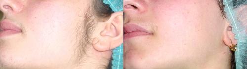 Фракционный термолиз- что это такое. Что такое Фракционный термолиз? 05 Фракционный термолиз- что это такое. Что такое Фракционный термолиз? 05