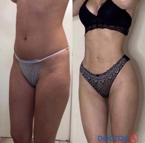 Как выглядит пресс при идеальном проценте жира в организме. Почему необходимо знать? 05