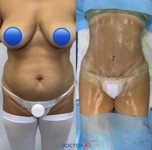 Как выглядит пресс при идеальном проценте жира в организме. Почему необходимо знать? 07