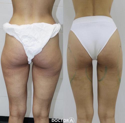 Как выглядит пресс при идеальном проценте жира в организме. Почему необходимо знать? 06