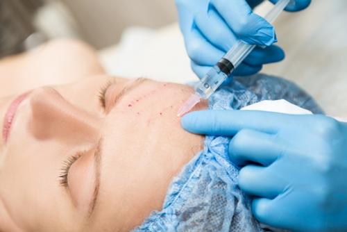 Что такое мезоботокс для лица. Ксеомин 01