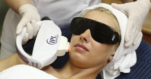 Какие бывают морщины на лице: полное руководство 07