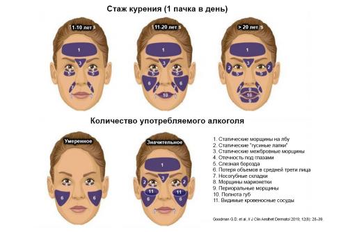 Морщины: причины появления и основные виды 02