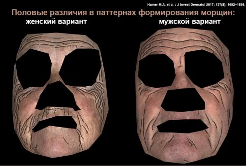 Какие бывают морщины на лице: полное руководство 08