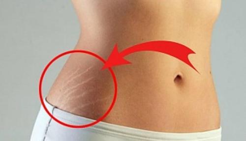 25 правил стройной фигуры. Простые правила для достижения стройной фигуры 03