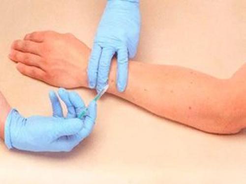 Возможности ботулинотерапии в косметологии и неврологии. Ботулинотерапия 01