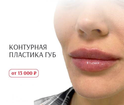 Как избавиться от комедонов на лице. Диагностика комедонов 04