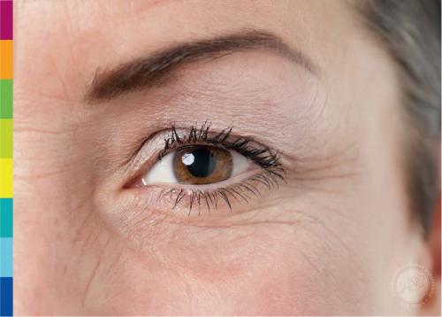 Крем от морщин под глазами посл. Советы профессиональных косметологов 01 Крем от морщин под глазами посл. Советы профессиональных косметологов 01