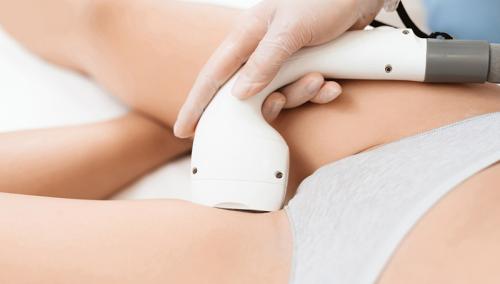 Как бриться перед лазерной эпиляцией глубокого бикини. Как подготовится к лазерной эпиляции бикини