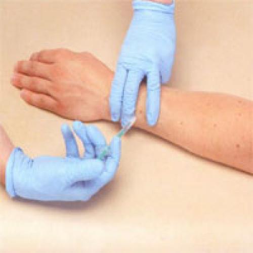 Ботулотоксин, что нельзя делать после процедуры. Памятка пациенту после инъекций ботулотоксинов (ботокс/диспорт) 06 Ботулотоксин, что нельзя делать после процедуры. Памятка пациенту после инъекций ботулотоксинов (ботокс/диспорт) 06