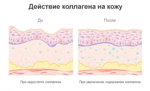 Коллаген от морщин вокруг глаз. Почему исчезает коллаген и к чему это приводит 01 Коллаген от морщин вокруг глаз. Почему исчезает коллаген и к чему это приводит 01