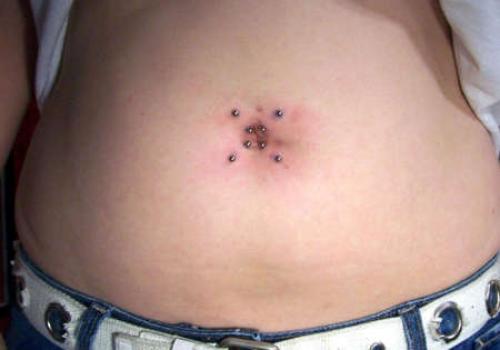 Чем заменить пирсинг в пупке при беременности. Пирсинг пупка и беременность: когда снимать и как сохранить