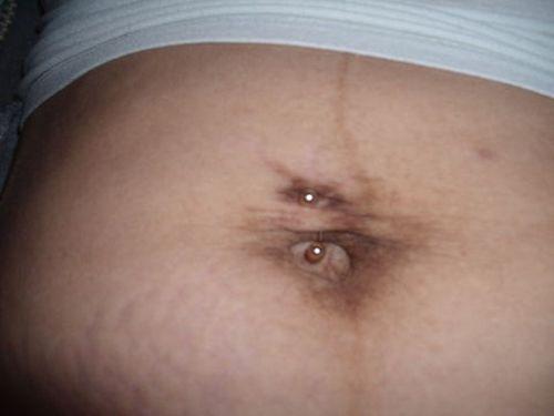 Снимать ли пирсинг во время беременности. Нужно ли снимать пирсинг пупка при беременности?