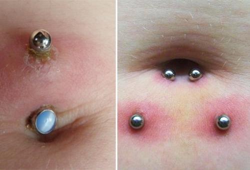 Снимать ли пирсинг во время беременности. Нужно ли снимать пирсинг пупка при беременности?