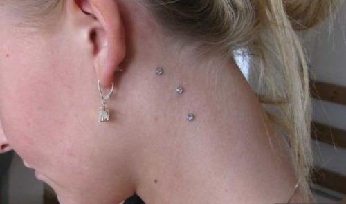 Тоннель в мочке уха. Пластика мочки уха 01