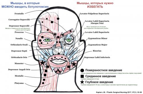 Карта безопасной глубины введения ботулотоксина: как избежать осложнений 09 Карта безопасной глубины введения ботулотоксина: как избежать осложнений 09