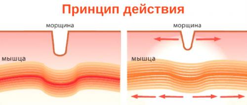 Сколько действует Ботокс на лице. Каковы косметические и лекарственные эффекты от ботокса 03