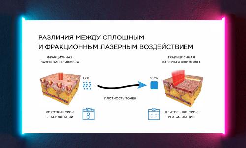 Какие преимущества имеют фракционные лазеры перед другими типами лазеров. Фракционный лазер: взаимодействие с кожей