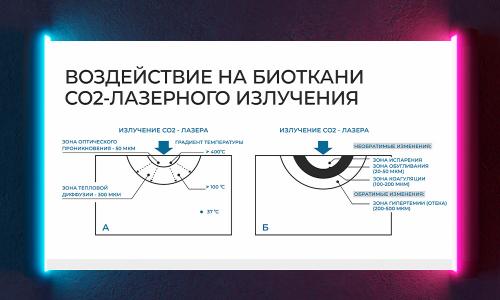 Какие преимущества имеют фракционные лазеры перед другими типами лазеров. Фракционный лазер: взаимодействие с кожей