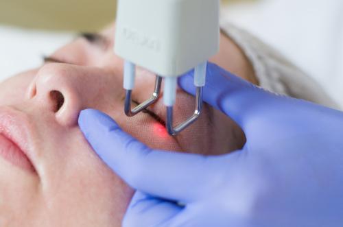 Как фракционные лазеры используются в медицине. Фракционные лазеры