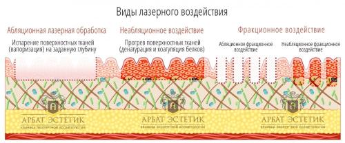 Есть ли какие-то противопоказания для лазерного омоложения кожи