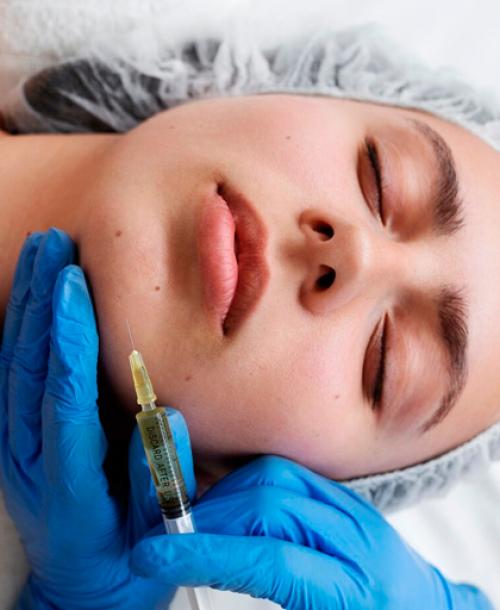 Подбородок без морщин: результаты после ботокса 06 Подбородок без морщин: результаты после ботокса 06