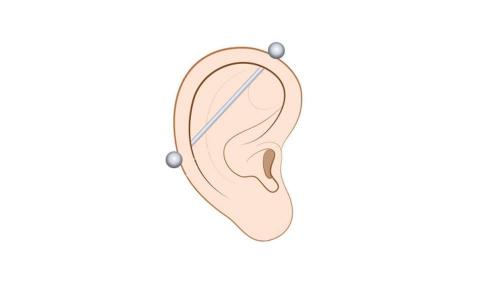 Как правильно ухаживать за ухом после ушинного пирсинга. Все виды пирсинга уха