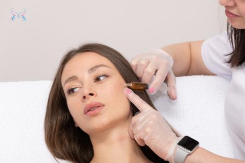 Лучшее средство от постакне. Как лечить постакне?