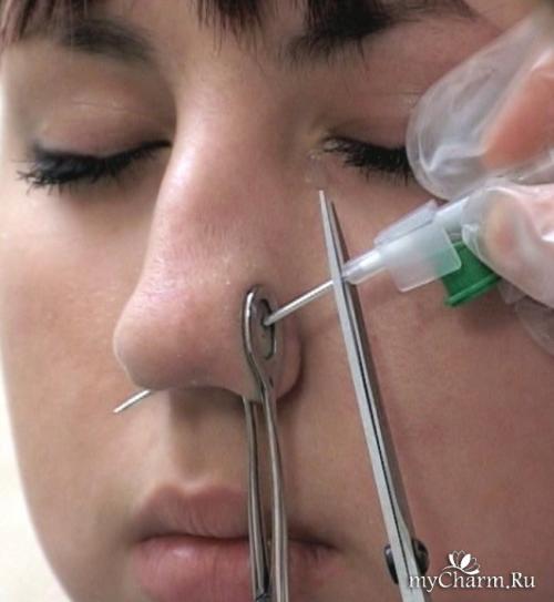 Пирсинг крыла носа заживление. Пирсинг носа: что нужно знать?