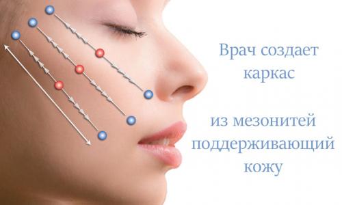Мезонити, что это такое. Суть методики