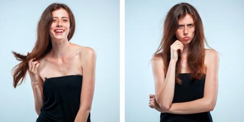 Виды морщин на лице. Классификация морщин 01 Виды морщин на лице. Классификация морщин 01