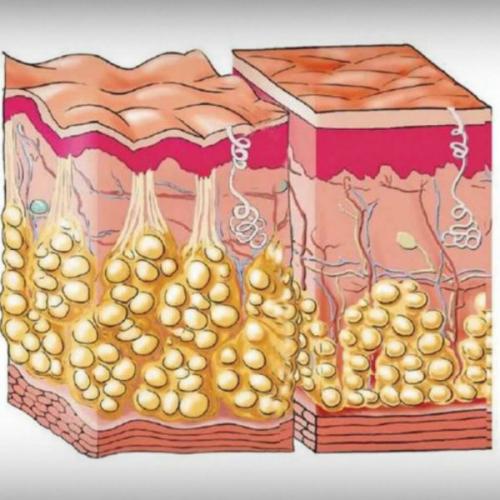 Процент жира у женщин. Что такое жировая ткань