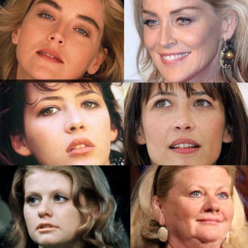 Мелкоморщинистый тип старения кожи лица. «Усталый» тип старения 04 Мелкоморщинистый тип старения кожи лица. «Усталый» тип старения 04