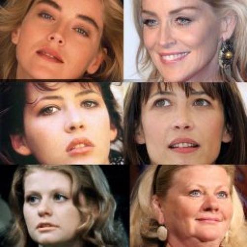 Мелкоморщинистый тип старения кожи лица. «Усталый» тип старения 02 Мелкоморщинистый тип старения кожи лица. «Усталый» тип старения 02