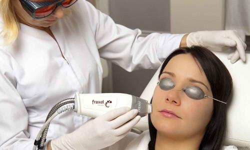 Как ухаживать за кожей лица посл.  Особенности антивозрастного ухода после 40 лет 01 Как ухаживать за кожей лица посл.  Особенности антивозрастного ухода после 40 лет 01