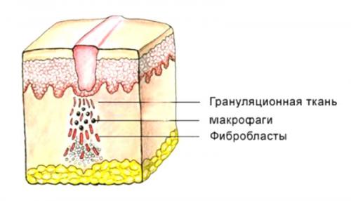 Что такое воспаление и как оно влияет на организм
