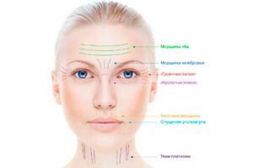 Виды и типы морщин на лице: полное руководство Виды и типы морщин на лице: полное руководство