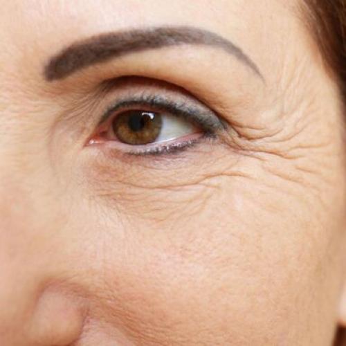 Как убрать мимические морщины вокруг глаз: эффективные методы Как убрать мимические морщины вокруг глаз: эффективные методы